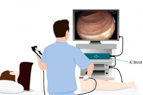 让医生6个月「废功」20%癌症检出率！J9真人游戏第一品牌柳叶刀惊曝：AI(图11)